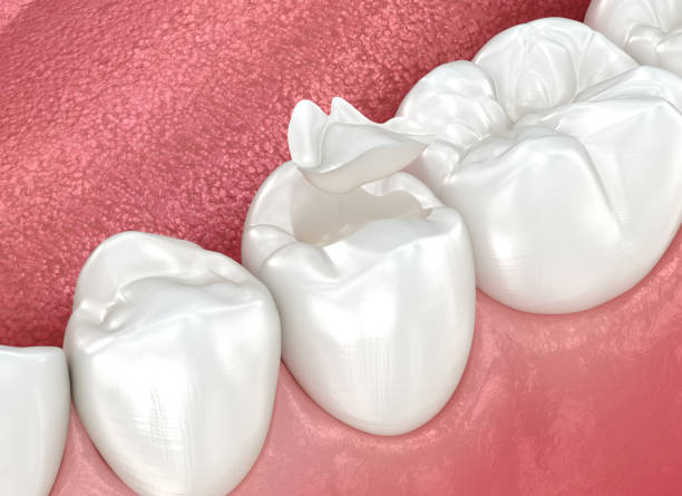 Best Dental Studio in Hazel Park, MI